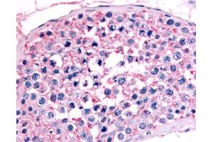 Anti-NR6A1 / GCNF antibody IHC of human testis.