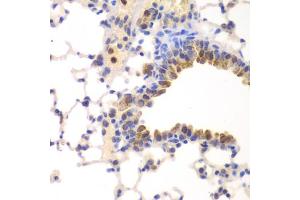 Immunohistochemistry of paraffin-embedded mouse lung using NFKB1 antibody (ABIN5974018) at dilution of 1/100 (40x lens). (NFKB1 anticorps)