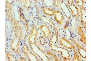 Immunohistochemistry of paraffin-embedded human kidney tissue using ABIN7154092 at dilution of 1:100