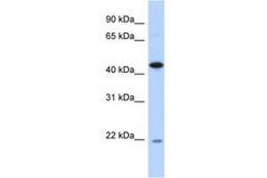 Image no. 1 for anti-RNA-Binding Protein NOB1 (NOB1) (AA 35-84) antibody (ABIN6741274) (NOB1 anticorps  (AA 35-84))