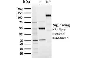 SDS-PAGE Analysis Purified Langerin Recombinant Rabbit Monoclonal Antibody (LGRN/3136R). (Recombinant CD207 anticorps  (AA 74-213))