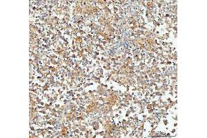 IHC analysis of CP110 using anti-CP110 antibody (ABIN5693312). (CP110 anticorps  (AA 51-284))