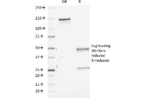 SDS-PAGE Analysis Purified TGF beta Mouse Monoclonal Antibody (TGFB/510). (TGF-beta anticorps)