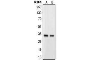 Western blot analysis of GPR82 expression in A549 (A), HeLa (B) whole cell lysates. (GPR82 anticorps  (Center))