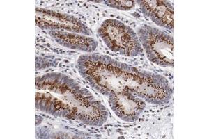 Immunohistochemical staining of human stomach with BEGAIN polyclonal antibody  shows strong cytoplasmic positivity in granular pattern in glandular cells at 1:200-1:500 dilution.