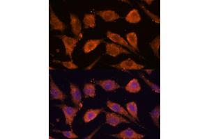 Immunofluorescence analysis of L929 cells using RHBDF1 antibody (ABIN7269977) at dilution of 1:100.