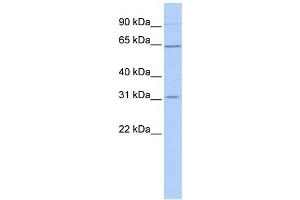 WB Suggested Anti-SLC27A2 Antibody Titration:  1 ug/ml  Positive Control:  Hela cell lysate (SLC27A2 anticorps  (N-Term))