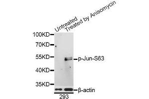 Western blot analysis of extracts of 293 cells, using Phospho-Jun-S63 antibody (ABIN5969905) at 1/1000 dilution. (C-JUN anticorps  (pSer63))