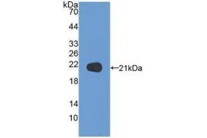 Detection of Recombinant NSF, Human using Polyclonal Antibody to N-Ethylmaleimide Sensitive Factor (NSF) (NSF anticorps  (AA 590-744))