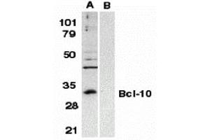 Western Blotting (WB) image for anti-B-Cell CLL/lymphoma 10 (BCL10) (N-Term) antibody (ABIN1031265) (BCL10 anticorps  (N-Term))