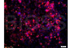 Formalin-fixed and paraffin embedded: human lung epithelial cells labeled with Anti-Glucocorticoid receptor(GR) Polyclonal Antibody, Unconjugated (ABIN726875) at 1:200,, followed by conjugation to the secondary antibody was Goat Anti-Rabbit IgG, PE conjugated at 1:200 for 40 minutes at 37°C