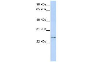 RCAN3 antibody used at 1 ug/ml to detect target protein.