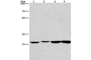 Western Blot analysis of Humna colon cancer and Mouse kidney tissue, Mouse testis and Human fetal brain tissue using KLF7 Polyclonal Antibody at dilution of 1:483. (KLF7 anticorps)
