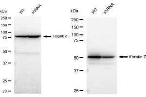 Western blotting analysis using Keratin 7 antibody (ABIN7799186). (Recombinant Cytokeratin 7 anticorps)