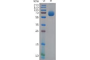 Human E Protein, His Tag on SDS-PAGE under reducing condition.