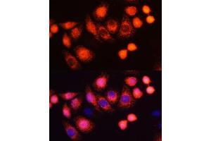 Immunofluorescence analysis of HeLa cells using HRAS antibody (ABIN6130448, ABIN6141983, ABIN6141985 and ABIN6215813) at dilution of 1:100 (40x lens). (HRAS anticorps  (AA 1-189))