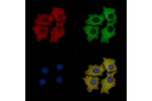 ALDOA Mouse Monoclonal Antibody staining HepG2 cells by IF/ICC. (ALDOA anticorps  (N-Term))
