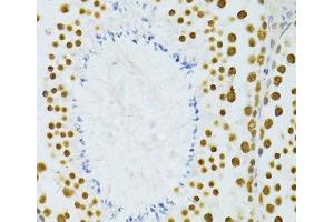 Immunohistochemistry of paraffin-embedded Mouse testis using ALYREF Polyclonal Antibody at dilution of 1:100 (40x lens).