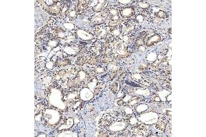 IHC analysis of Syntenin 2/SDCBP2 using anti-Syntenin 2/SDCBP2 antibody (ABIN7600017).
