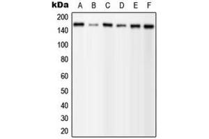 Western blot analysis of PLC gamma 1 (pY1253) expression in MCF7 EGF-treated (A), A431 (B), mouse brain (C), mouse liver (D), H9C2 EGF-treated (E) whole cell lysates. (Phospholipase C gamma 1 anticorps  (C-Term, pTyr1253))