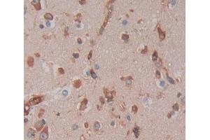 IHC-P analysis of brain tissue, with DAB staining. (GTF3A anticorps  (AA 71-365))