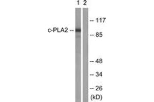 Western blot analysis of extracts from HeLa cells, treated with TNF-a 20ng/ml 30', using c-PLA2 (Ab-505) Antibody. (C-PLA2 (AA 471-520) anticorps)