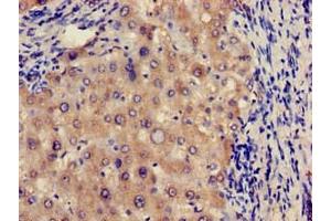 Immunohistochemistry of paraffin-embedded human liver tissue using ABIN7172206 at dilution of 1:100 (FUCA1 anticorps  (AA 32-158))