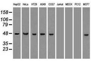 Image no. 3 for anti-Keratin 18 (KRT18) (AA 69-372) antibody (ABIN1491638) (Cytokeratin 18 anticorps  (AA 69-372))