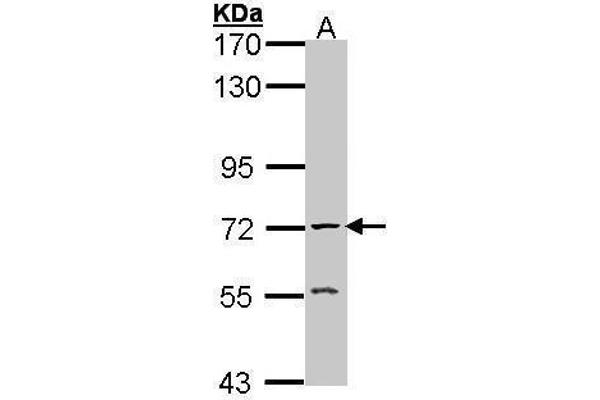 Acetylcholinesterase Antikörper  (C-Term)