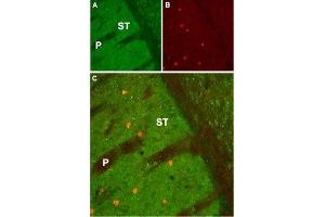 Expression of Muscarinic acetylcholine receptor M1 in mouse striatum - Immunohistochemical staining of mouse striatum (ST) using Anti-CHRM1 Antibody (ABIN7043060, ABIN7044580 and ABIN7044581).