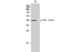 Western Blotting (WB) image for anti-Protein Tob1 (TOB1) (pSer164) antibody (ABIN3173342) (Protein Tob1 (TOB1) (pSer164) anticorps)