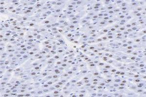 Immunohistochemistry analysis of paraffin-embedded rat liver using,SET (ABIN7075583) at dilution of 1: 10000