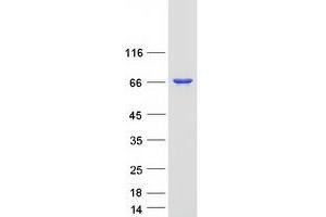 Validation with Western Blot