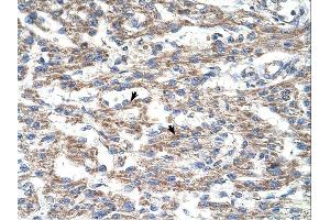 DUT antibody was used for immunohistochemistry at a concentration of 4-8 ug/ml. (Deoxyuridine Triphosphatase (DUT) (N-Term) anticorps)