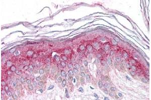 Human Skin: Formalin-Fixed, Paraffin-Embedded (FFPE)