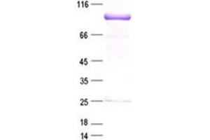 Validation with Western Blot