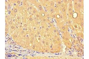 Immunohistochemistry of paraffin-embedded human liver tissue using ABIN7159849 at dilution of 1:100 (Slc25a1 anticorps  (AA 124-162))