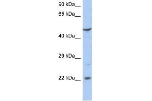 WB Suggested Anti-FLJ44894 Antibody Titration:  0. (FLJ44894 anticorps  (N-Term))