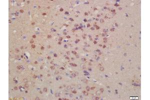 Formalin-fixed and paraffin embedded rat brain labeled with Rabbit Anti- Pro-Neuregulin Polyclonal Antibody, Unconjugated  at 1:200 followed by conjugation to the secondary antibody and DAB staining