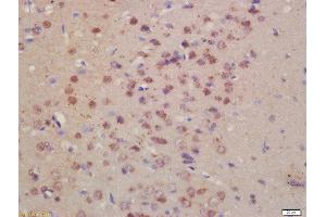 Formalin-fixed and paraffin embedded rat brain labeled with Rabbit Anti- Pro-Neuregulin Polyclonal Antibody, Unconjugated  at 1:200 followed by conjugation to the secondary antibody and DAB staining (Neuregulin 1 anticorps  (AA 221-320))