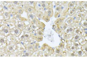 Immunohistochemistry of paraffin-embedded Mouse liver using PSMA7 Polyclonal Antibody at dilution of 1:100 (40x lens).