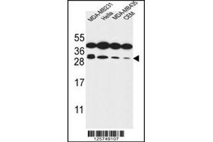 Western blot analysis of Syntaxin 10 / STX10 Antibody (N-term) in MDA-MB231, Hela, MDA-MB435, CEM cell line lysates (35ug/lane). (Syntaxin 10 anticorps  (N-Term))