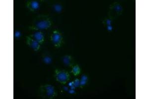 Anti-AK3 mouse monoclonal antibody (ABIN2452718) immunofluorescent staining of COS7 cells transiently transfected by pCMV6-ENTRY AK3 (RC204408). (Adenylate Kinase 3 anticorps)
