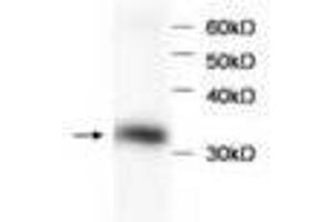 Image no. 1 for anti-Hemoglobin beta (HBB) antibody (ABIN791524) (Hemoglobin Subunit beta anticorps)