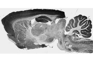 Adult rat whole brain immunohistochemistry. (KCNT2 anticorps  (AA 564-624))