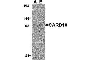 Western blot analysis of CARD10 expression in EL4 cell lysate with AP30183PU-N CARD10 antibody at (A) 5 and (B) 10 μg /ml. (CARD10 anticorps)