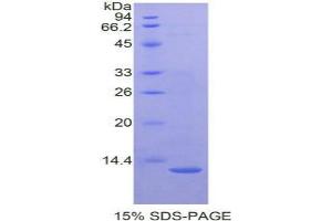 SDS-PAGE analysis of Mouse CTNNbIP1 Protein. (CTNNBIP1 Protéine)