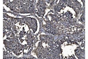 IHC analysis of DYNLL1/PIN using anti-DYNLL1/PIN antibody (ABIN7599571).