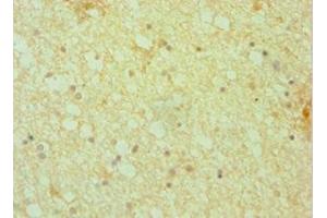Immunohistochemistry of paraffin-embedded human brain tissue using ABIN7150804 at dilution of 1:100