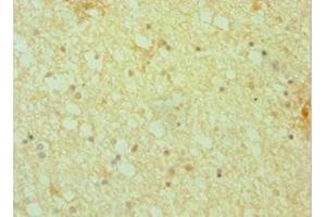 Immunohistochemistry of paraffin-embedded human brain tissue using ABIN7150804 at dilution of 1:100 (Dynactin 1 anticorps  (AA 1084-1278))